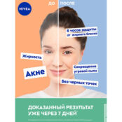 NIVEA Сыворотка для ежедневного ухода ACNE EXPERT NIV994280 фото 5